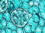 4055A | Control Slides:Histopathology; Basement Membrane